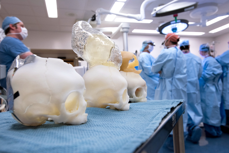 Prior to the surgery, doctors had the benefit of practicing and refining the procedure using 3D-printed models of Bentley’s skull and brain sac. (Image: Katherine C. Cohen/Boston Children’s Hospital)